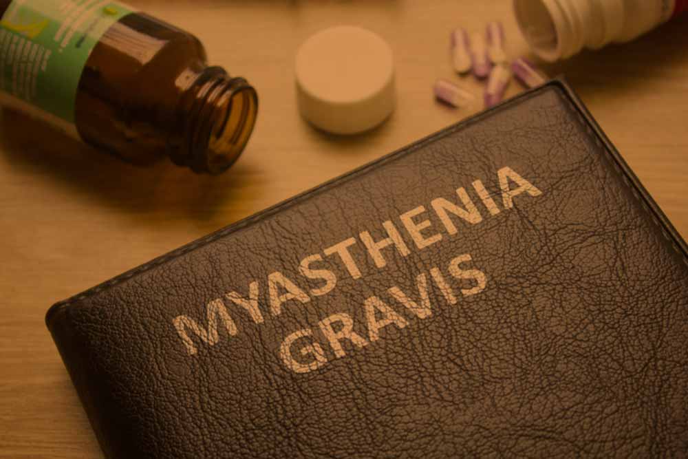 miastenija-zdravljenje